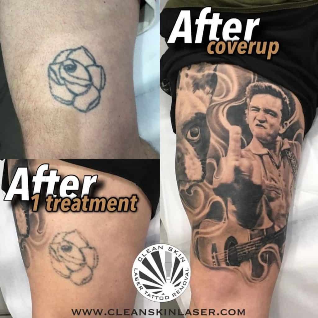 Cover-Up Tattoos