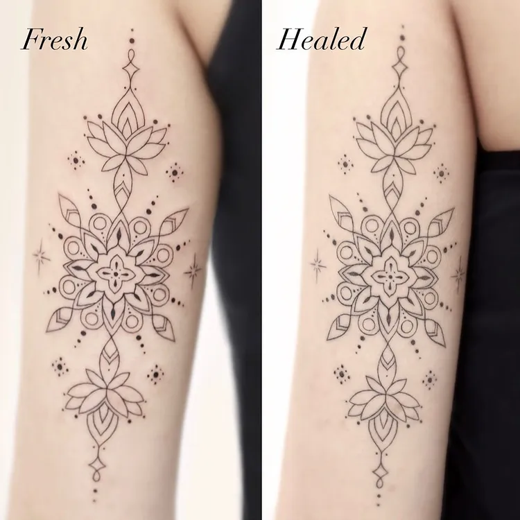 before and after photos for tattoo peeling